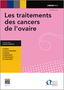 Les traitements des cancers de l'ovaire Image 1